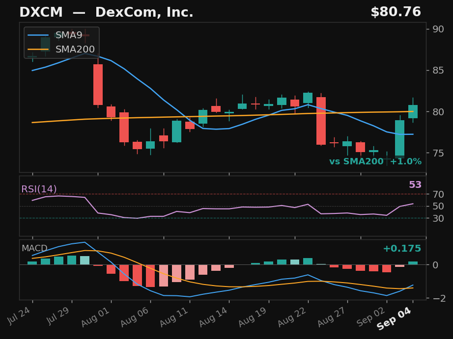 DXCM chart